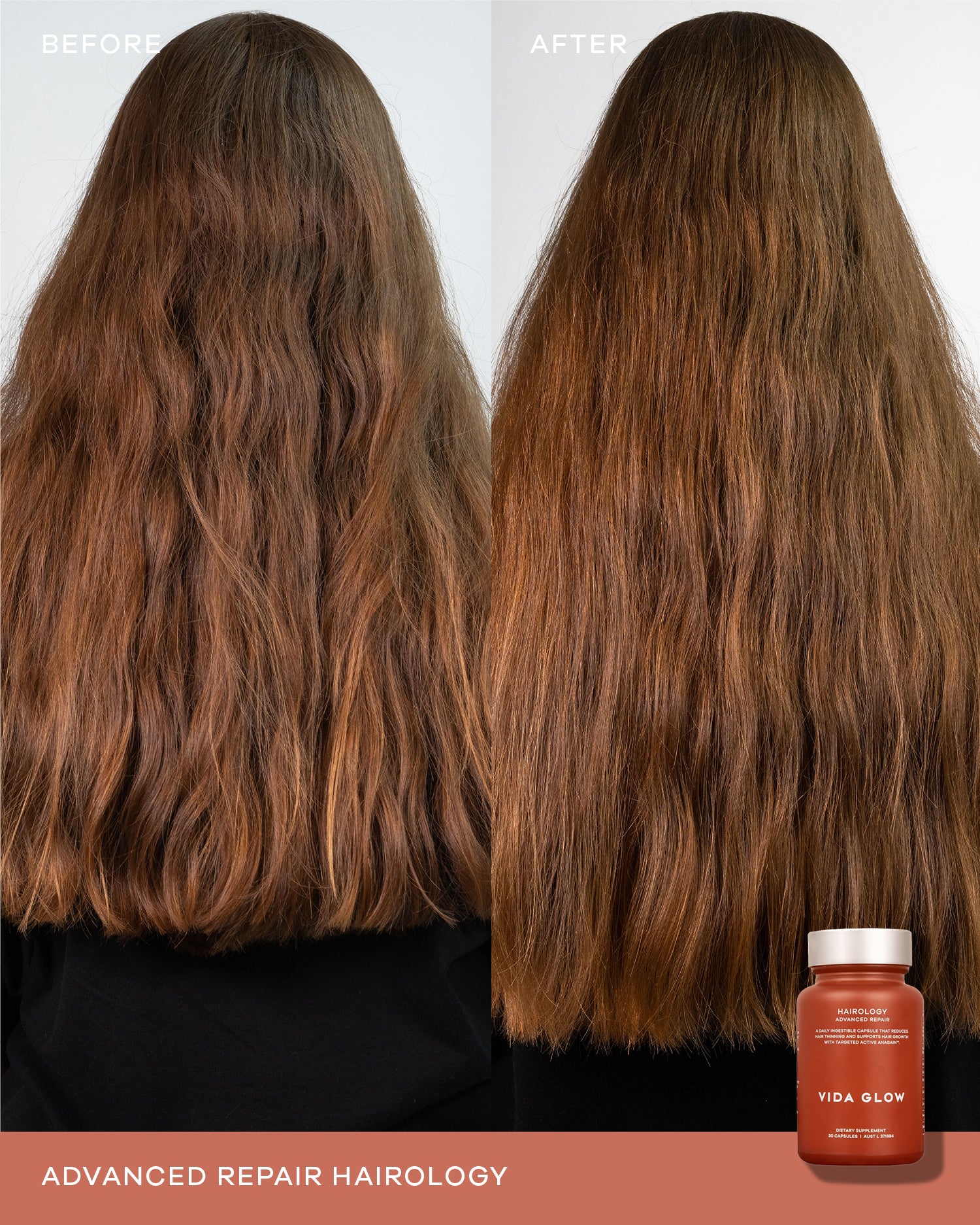 Hairology Capsules - Image 4
